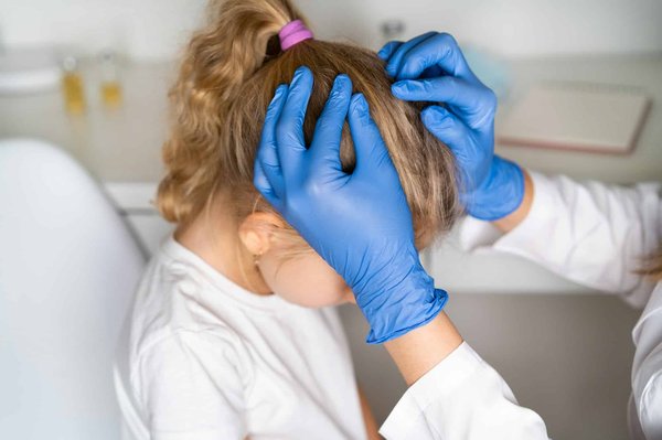 Comment choisir une gamme de produits naturels efficace contre les poux ?